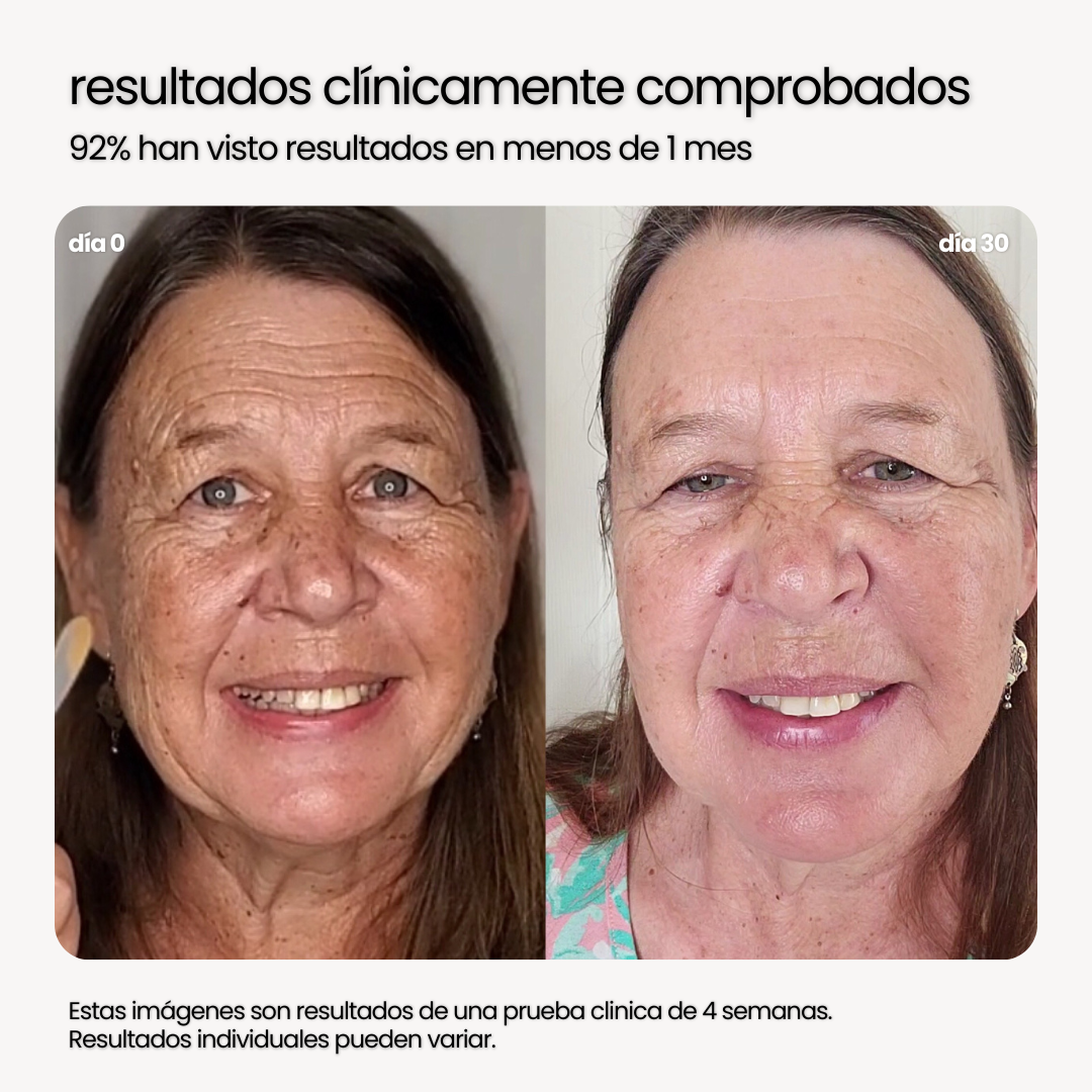 NUTRIBELLA™ - EL SECRETO PARA EL REJUVENECIMIENTO (90 CAPSULAS)