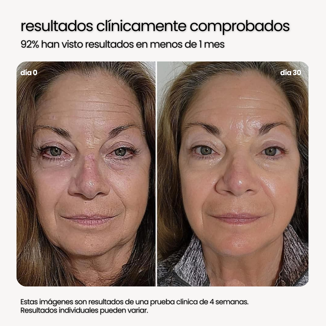 NUTRIBELLA™ - EL SECRETO PARA EL REJUVENECIMIENTO (90 CAPSULAS)