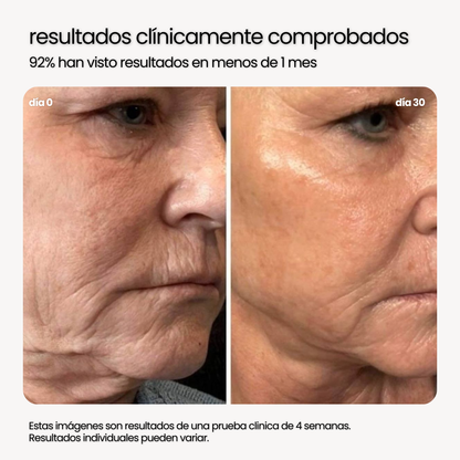 NUTRIBELLA™ - EL SECRETO PARA EL REJUVENECIMIENTO (90 CAPSULAS)