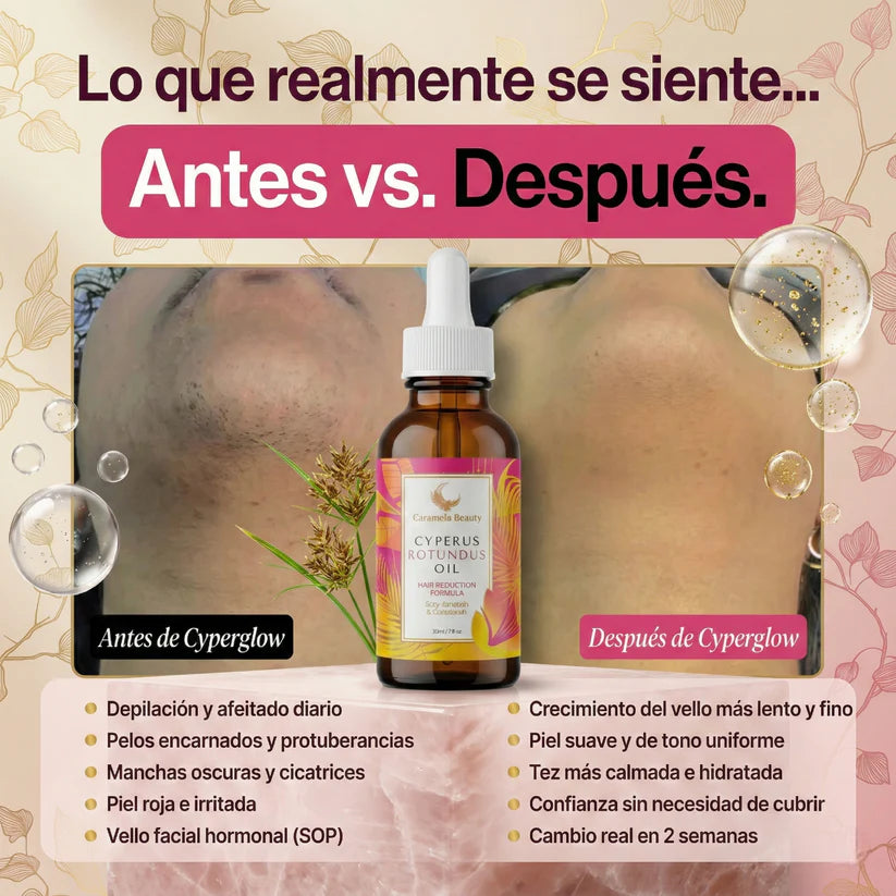 Cyperus Rotundus Oil (60 ml) | para la reducción natural del vello