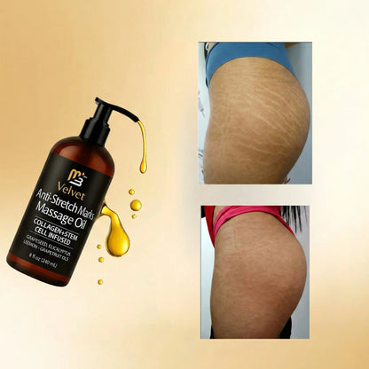 Aceite Anti-Estrias Velvet™